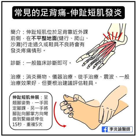 腳背突然長毛|腳背長毛與財運有何關係？